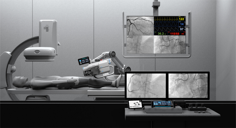 君創(chuàng)Portfolio|中科鴻泰血管介入手術機器人進入創(chuàng)新醫(yī)療器械“綠色通道”